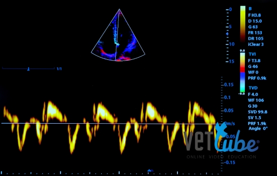 Echocardiographie: examen Doppler