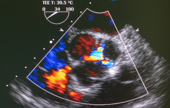 ID1046 - Elite Echocardiografie - Editie 3